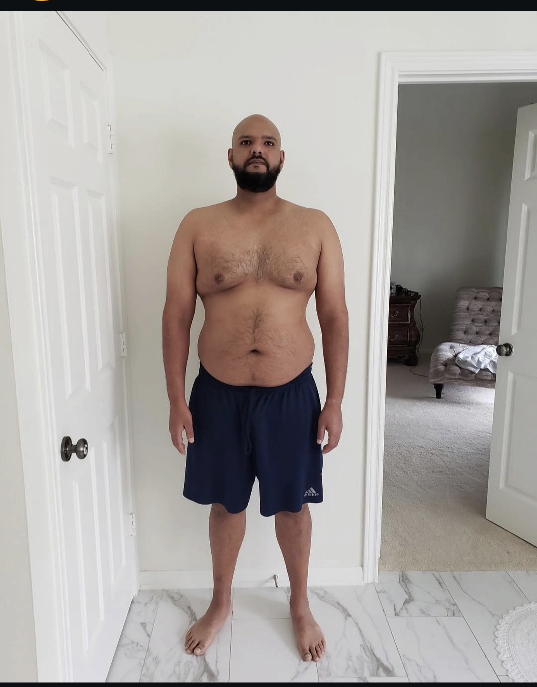 Client before photo